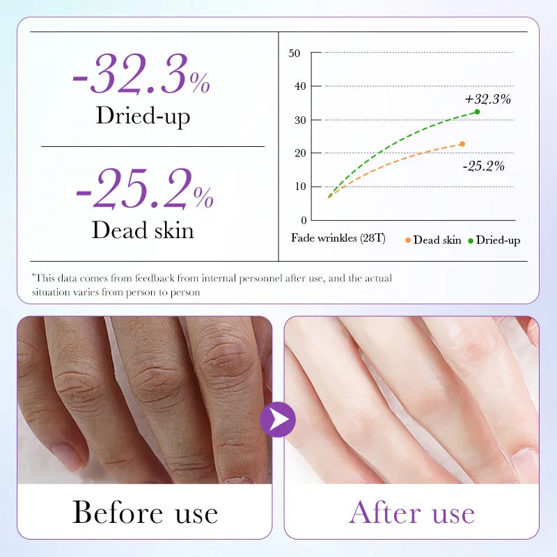 Exfoliating and Whitening Spa Gloves