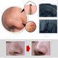 Blackhead Remover Nose Face Mask