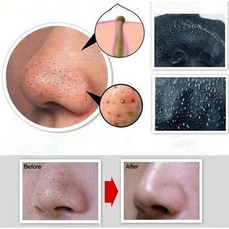 Blackhead Remover Nose Face Mask