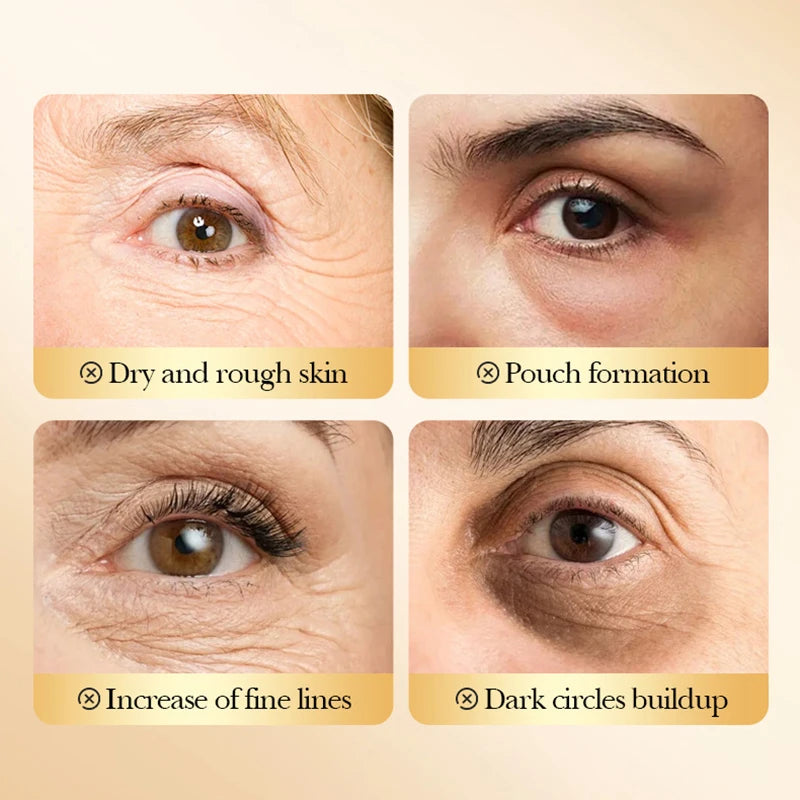 Collagen Gel Dark Circles Remover Eye Patches